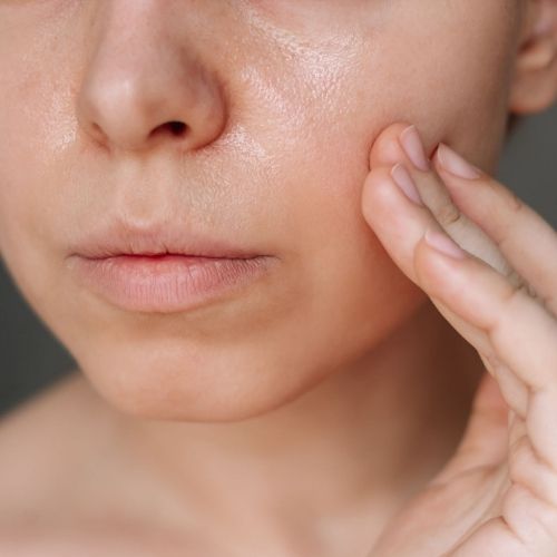 Masna i mješovita koža